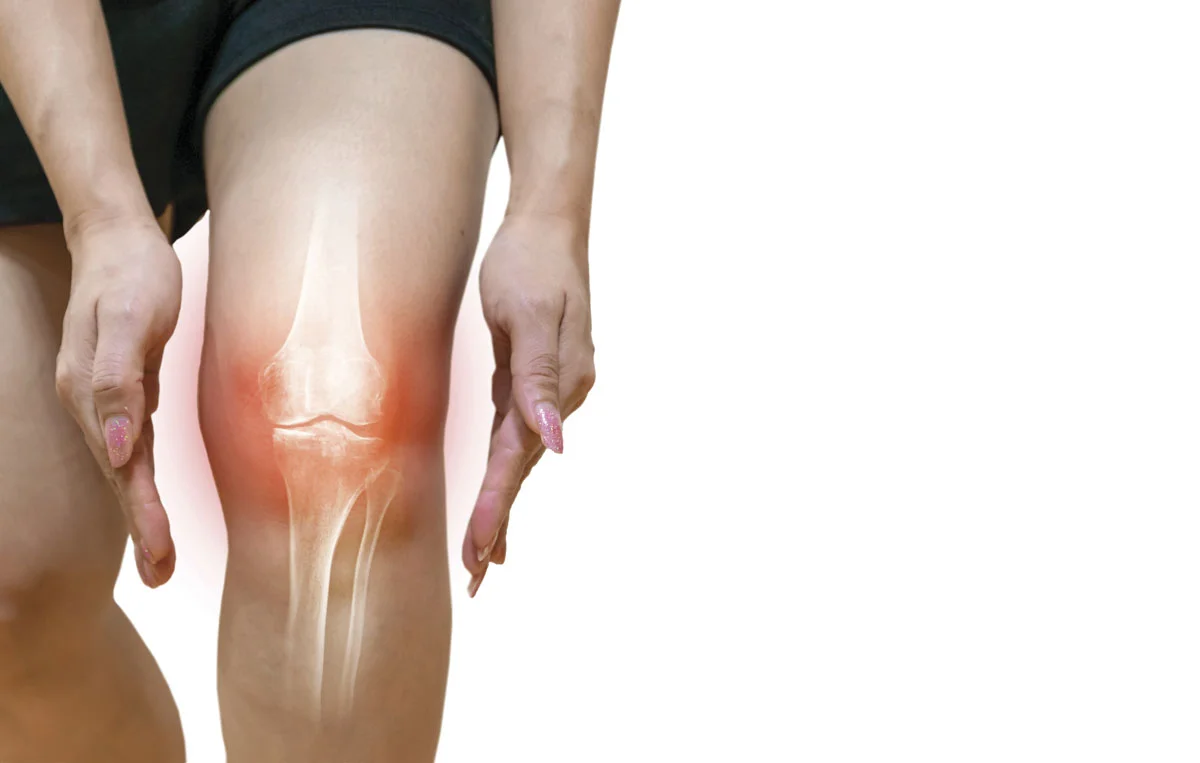 آرتروز زانو (استئوآرتریت)تقویت عضلات دورکننده ران در مقابل عضلات نزدیک‌کننده ران